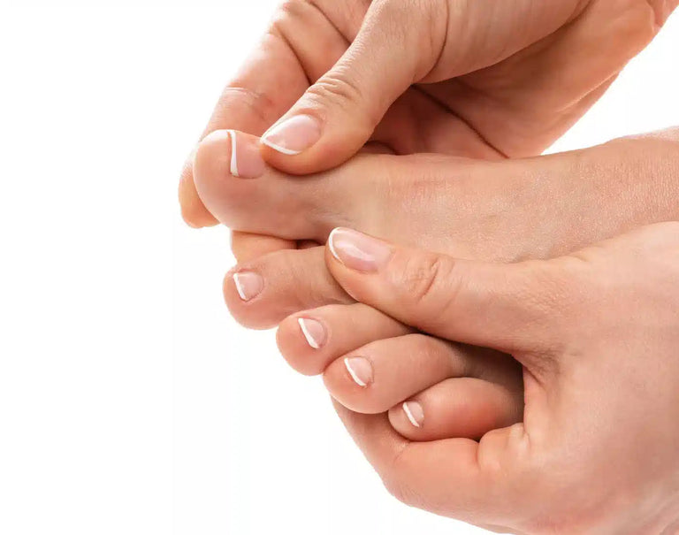 Recognising And Treating Onychomycosis (Fungal Nail)