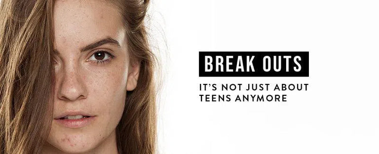 Breakouts, It's Not Just About Teens Anymore