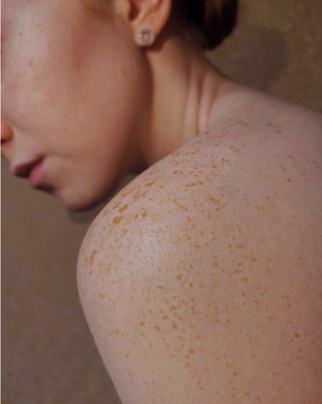 Skin Conditions